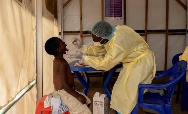 a laboratory nurse takes a sample from a child declared a suspected case mpox at a treatment centre in munigi north kivu province democratic republic of the congo on july 19 2024 photo reuters