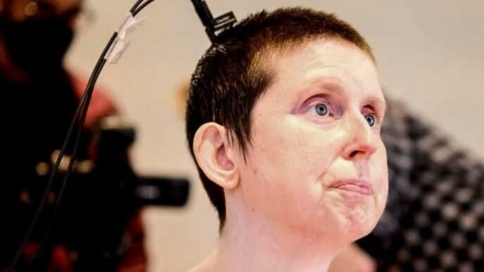 A stroke survivor speaks again with the help of an experimental brain-computer implant