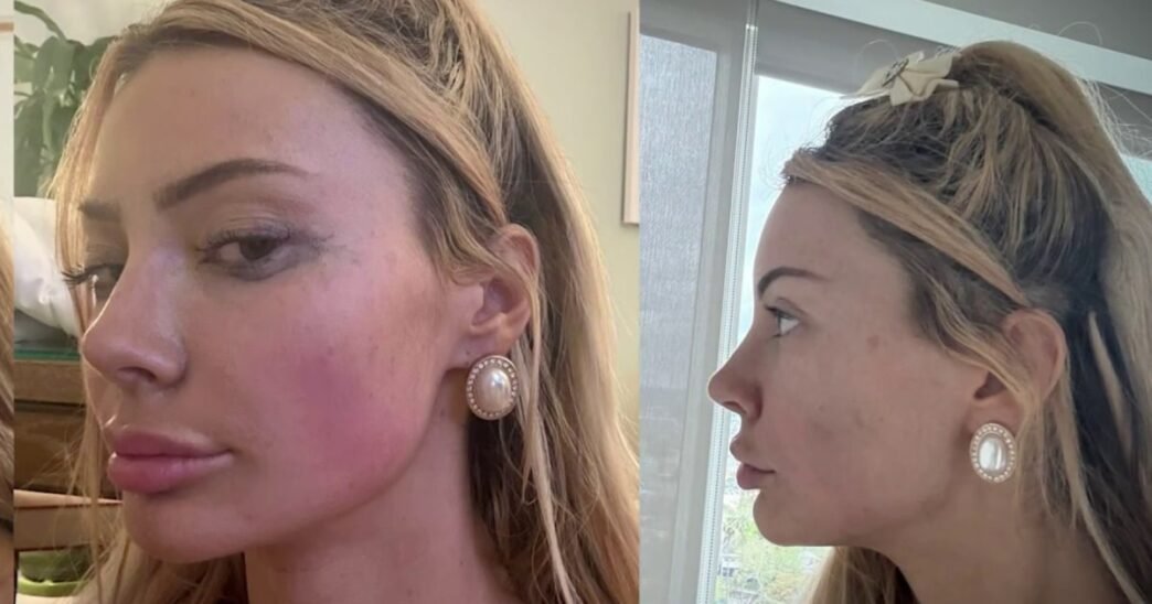 Andrew Tate accuser speaks out on alleged abuse and violent encounter