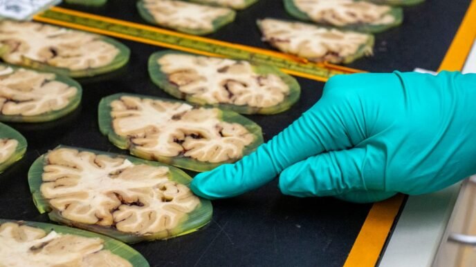 One of the country’s leading Alzheimer’s projects is in jeopardy