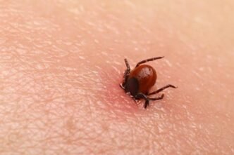 Quetta reports first Congo virus death of 2025, cases rise to 41 in Balochistan