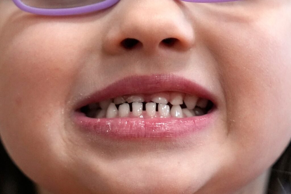 FDA and RFK Jr. aim to remove fluoride supplements used to protect kids' teeth