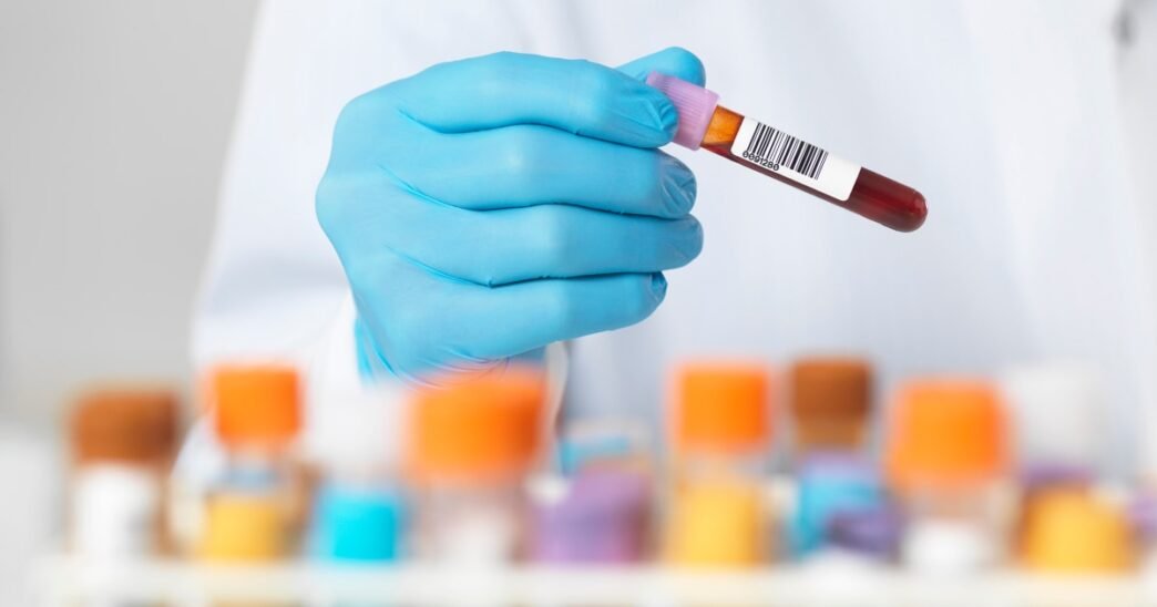 New cholesterol drug lowers LDL levels when statins aren’t enough, study finds