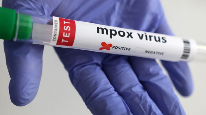 Smart lockdown imposed in Jamrud amid Mpox outbreak